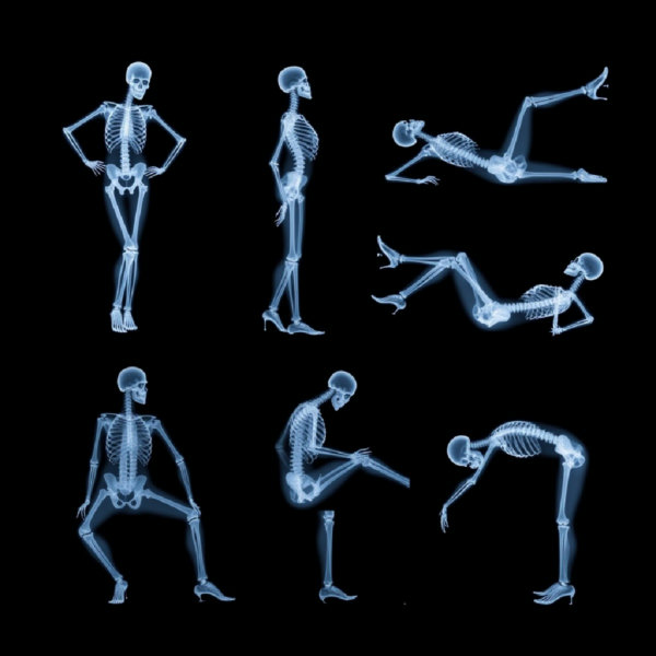CTAI-XRay - v1.0
